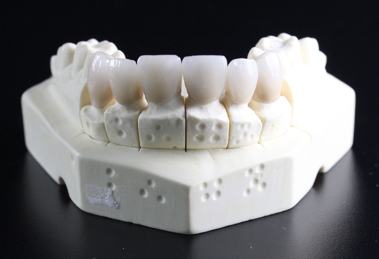 Protezy zębowe – rozwiązanie na luki w uzębieniu